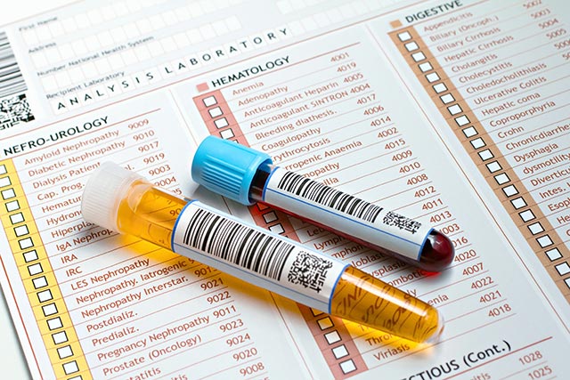 A sample blood test and urine test on top of a Laboratory report