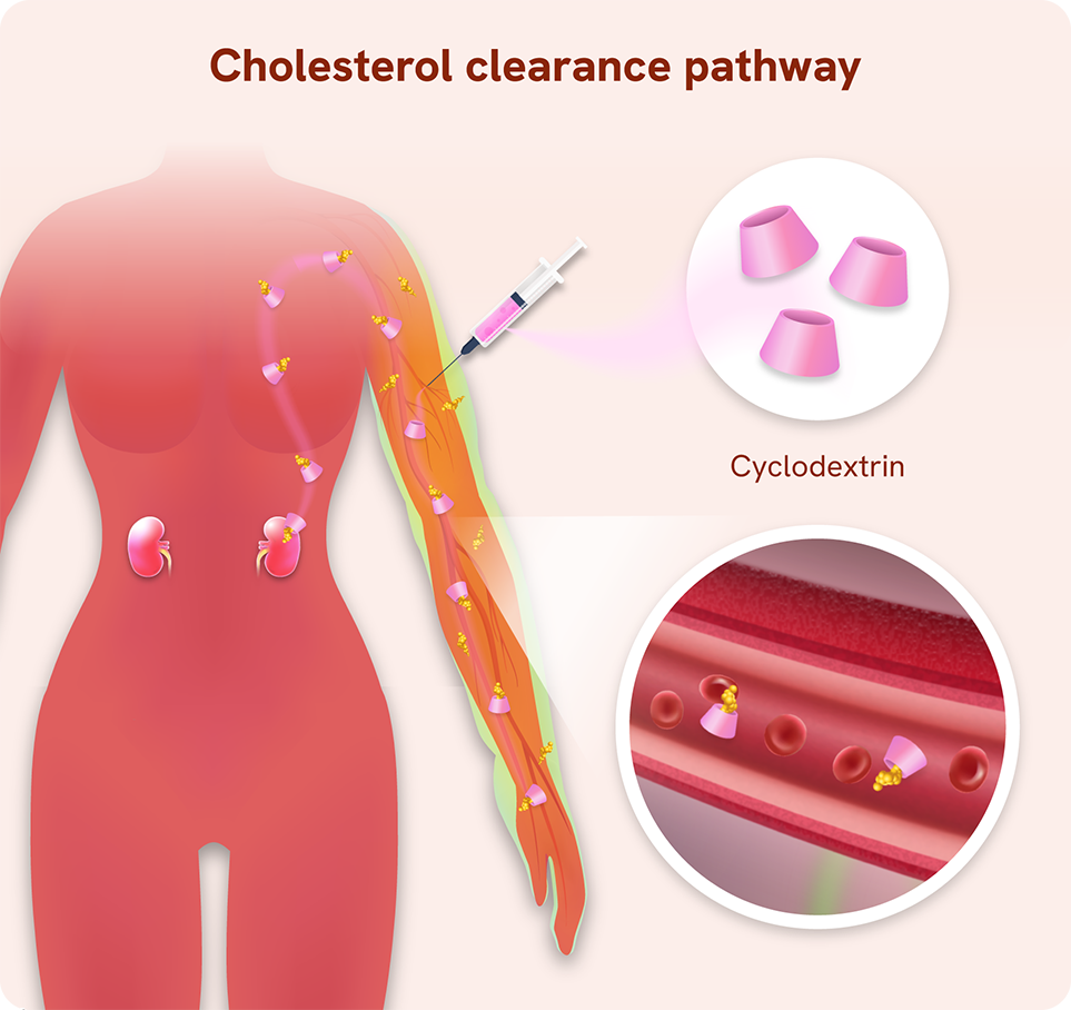 4_Lymphoedema treatments v2