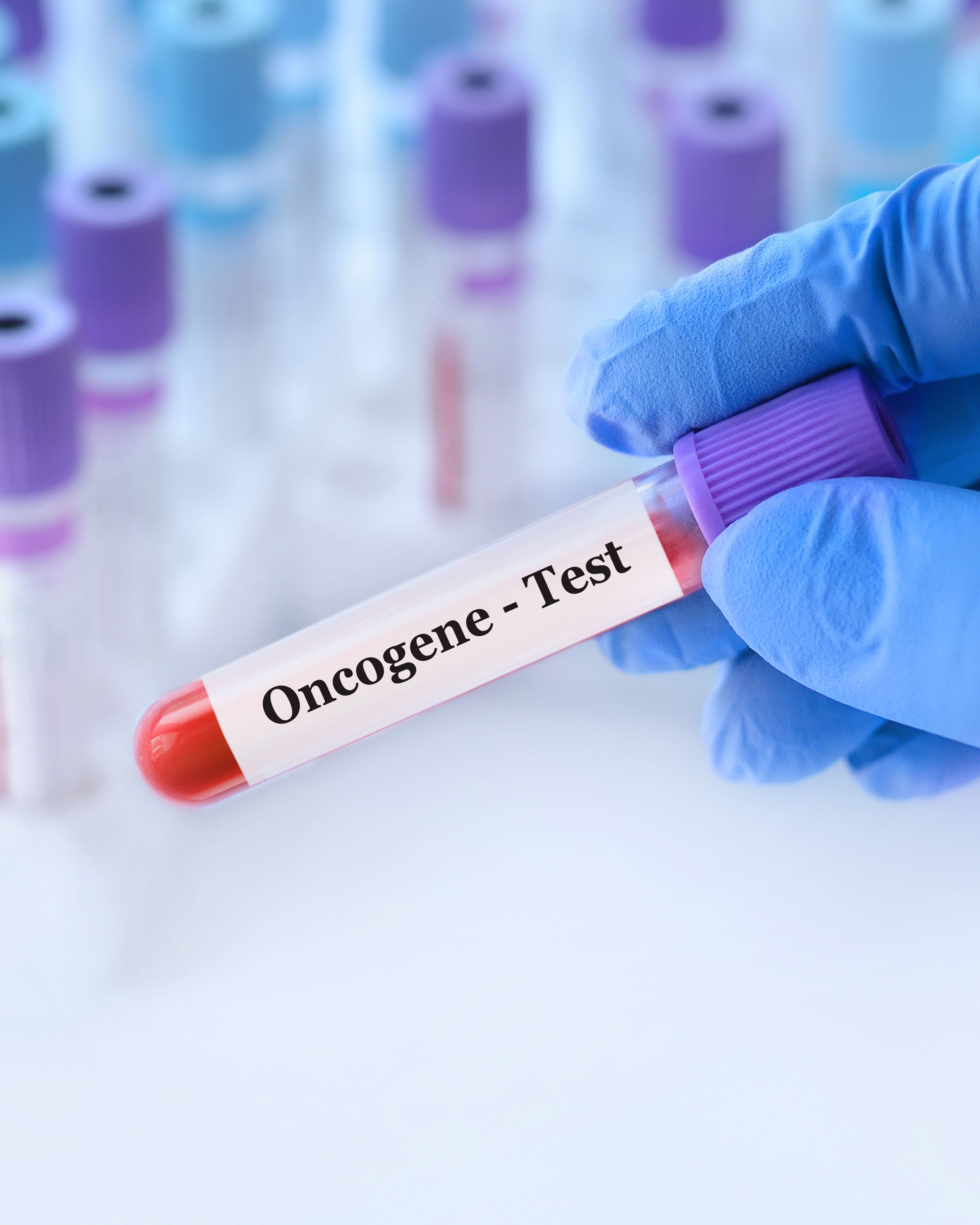 oncogene test 4x5