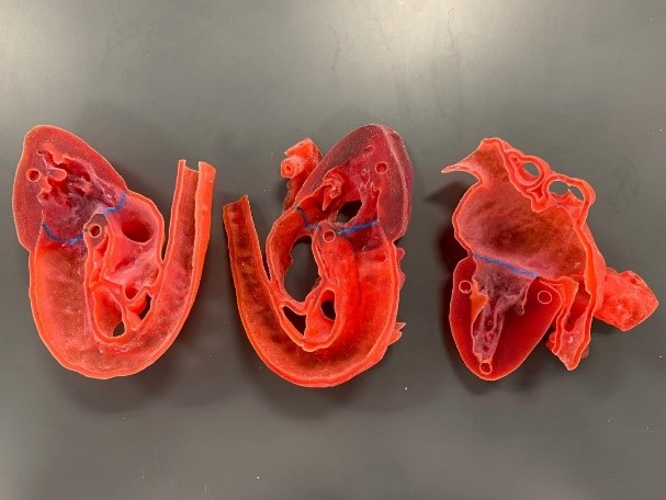 3D-Printed Heart Model